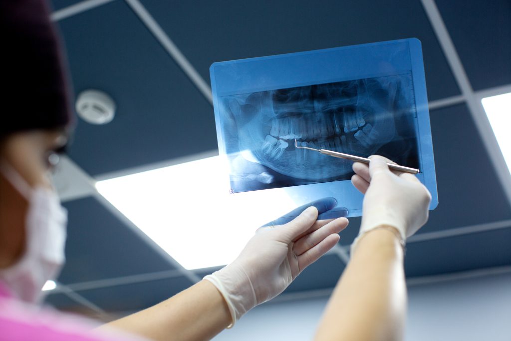 رادیوگرافی دندان یا عکسبرداری دندان