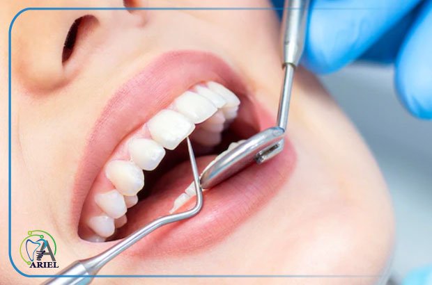 تفاوت میان پر کردن و ترمیم دندان