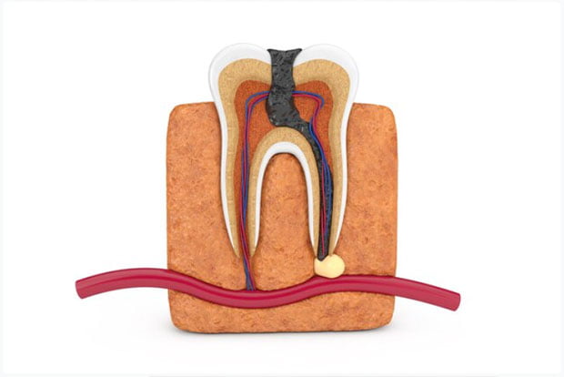 تفاوت اندودنتیست با دندانپزشک عمومی