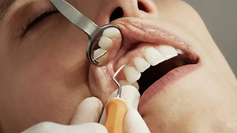 مزایای بروساژ دندان