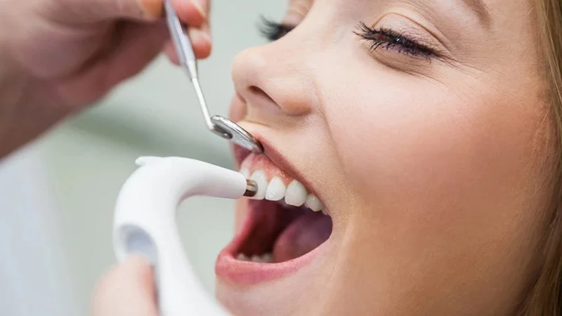 اهمیت انجام بروساژ دندان