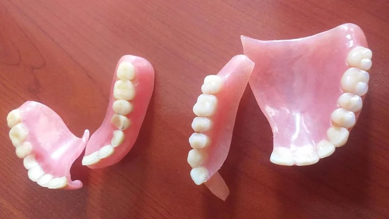 انواع دندان مصنوعی تکه ای